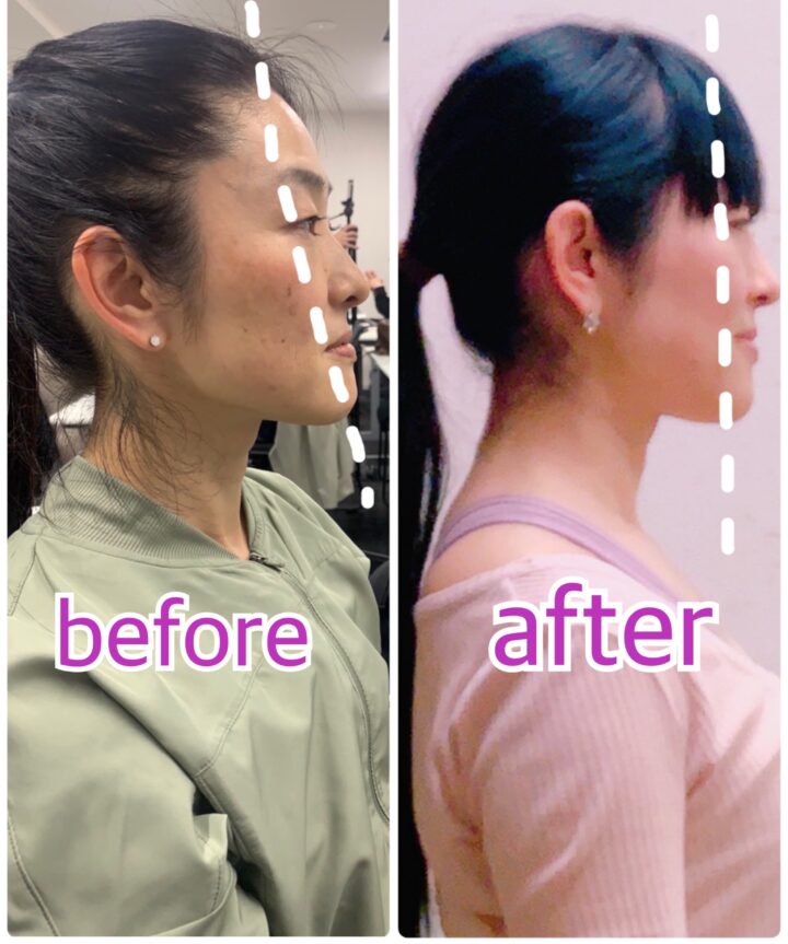 顔の左右差・ほうれい線が変わるパーソナルトレーニング｜骨格×小顔を50代から【スタジオS国立】の画像