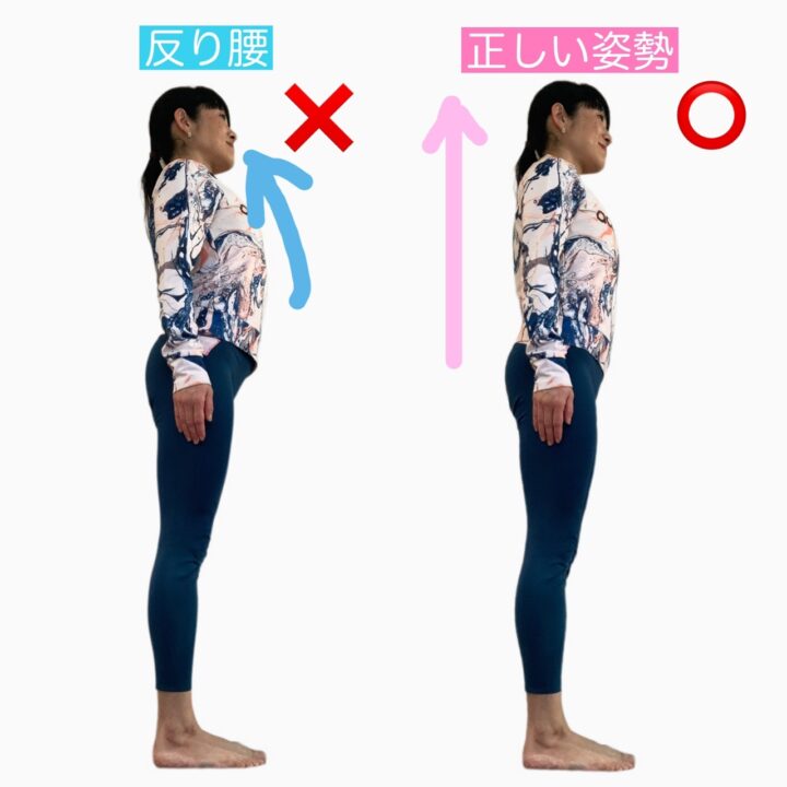 反り腰がぽっこりお腹つくる？同時改善ストレッチの画像