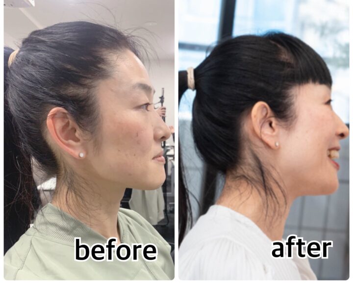 顔のたるみは“顔が原因じゃない”骨盤と姿勢の関係の画像
