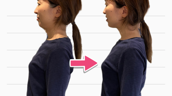 ストレートネックと二重アゴ|顔のたるみをつくる「正しい姿勢」の落とし穴の画像